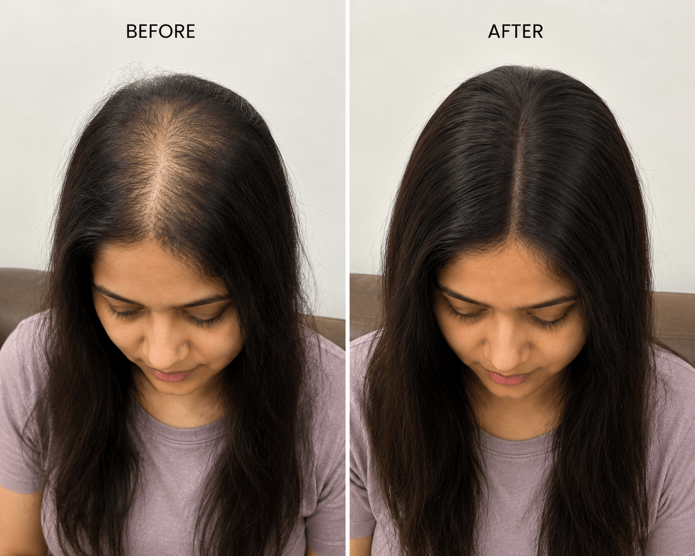 Human Hair Silk Base Topper 20 Inch | 100% Natural Human Hair - Image 5